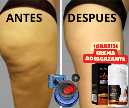 Adiós Celulitis, Hola Confianza